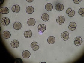 Image of bacteria under a microscope.
